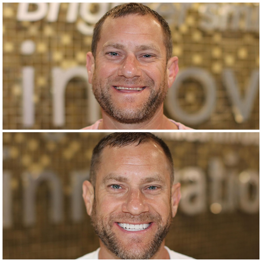 Grant Olson Case Study